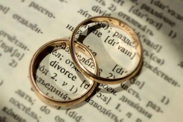 Image of rings removed before divorce mediation Ilkeston
